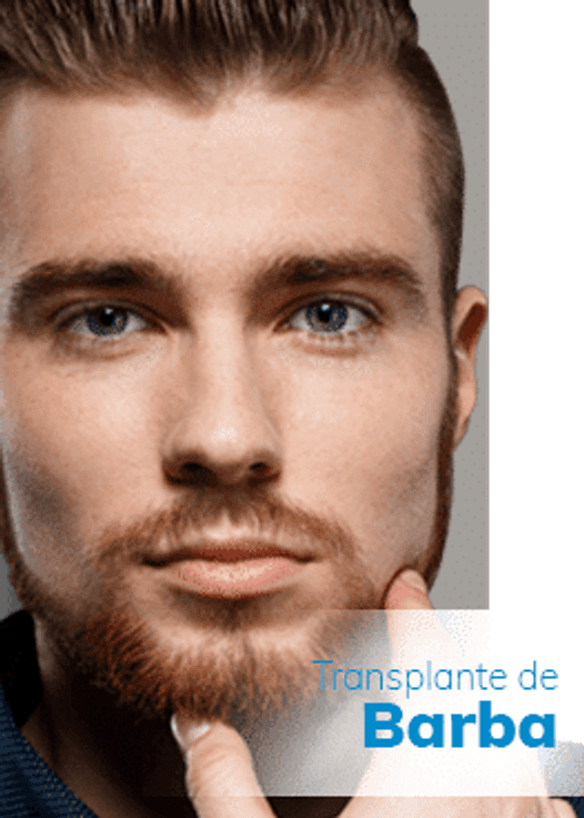 Implante de barba
