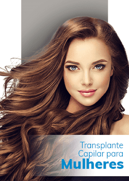 Implante capilar feminino