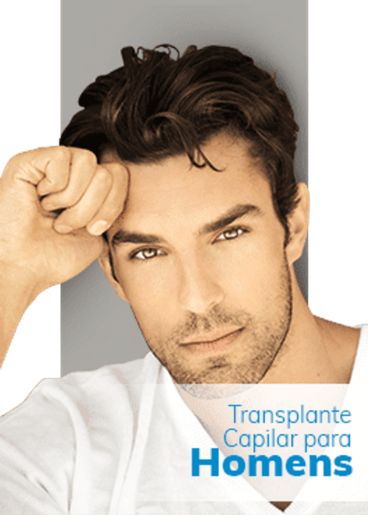 Implante capilar masculino