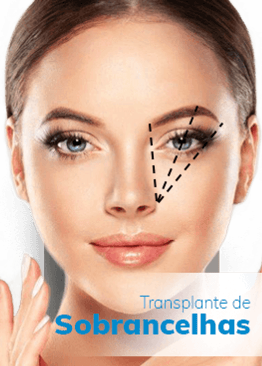 Implante de sobrancelhas